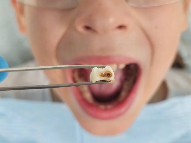 Best Walk-In Emergency Dentist in Palmer, TX